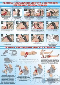 Стенд «Техніка накладання джгута» (Артикул: 3-0390)  